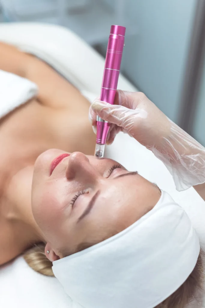 Body Basix Signature Skin Rituals 3 microneedling