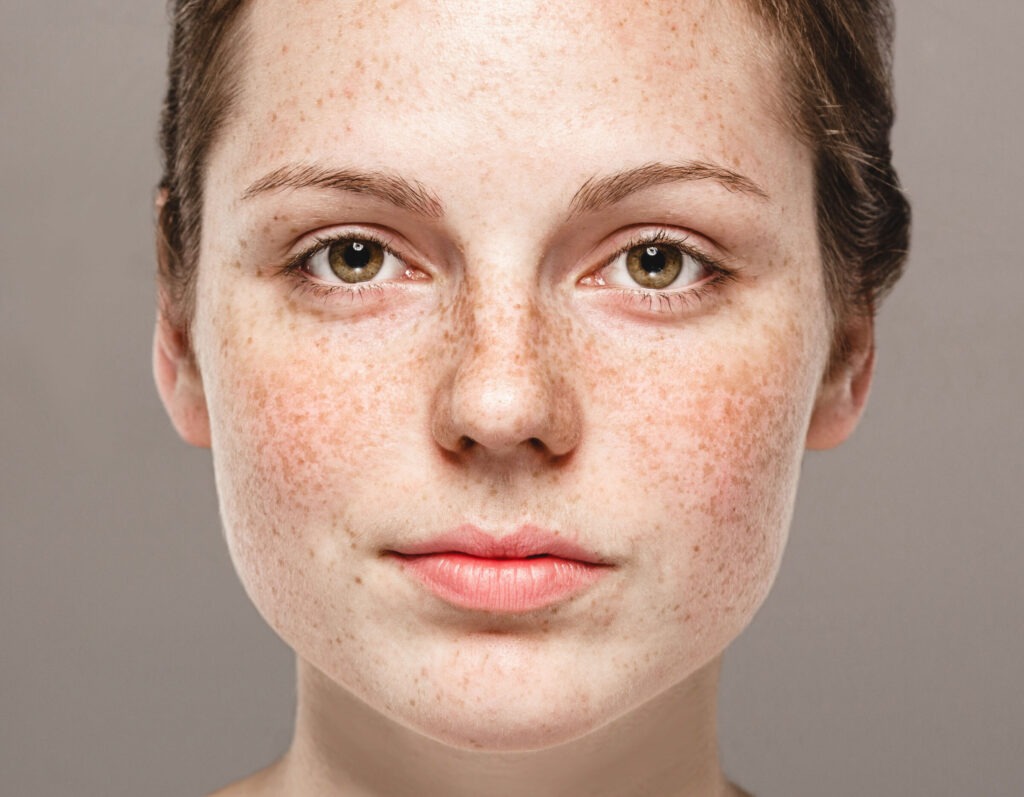 young beautiful freckles woman face portrait with 2025 02 10 13 50 22 utc