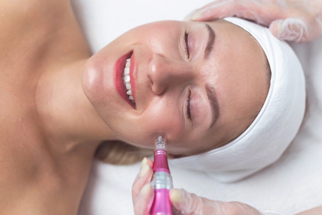Microneedling 3 woman having facial treatment in beauty salon clo 2025 02 12 23 00 09 utc